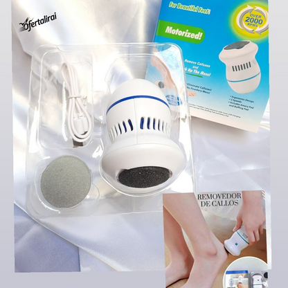 Removedor de callos